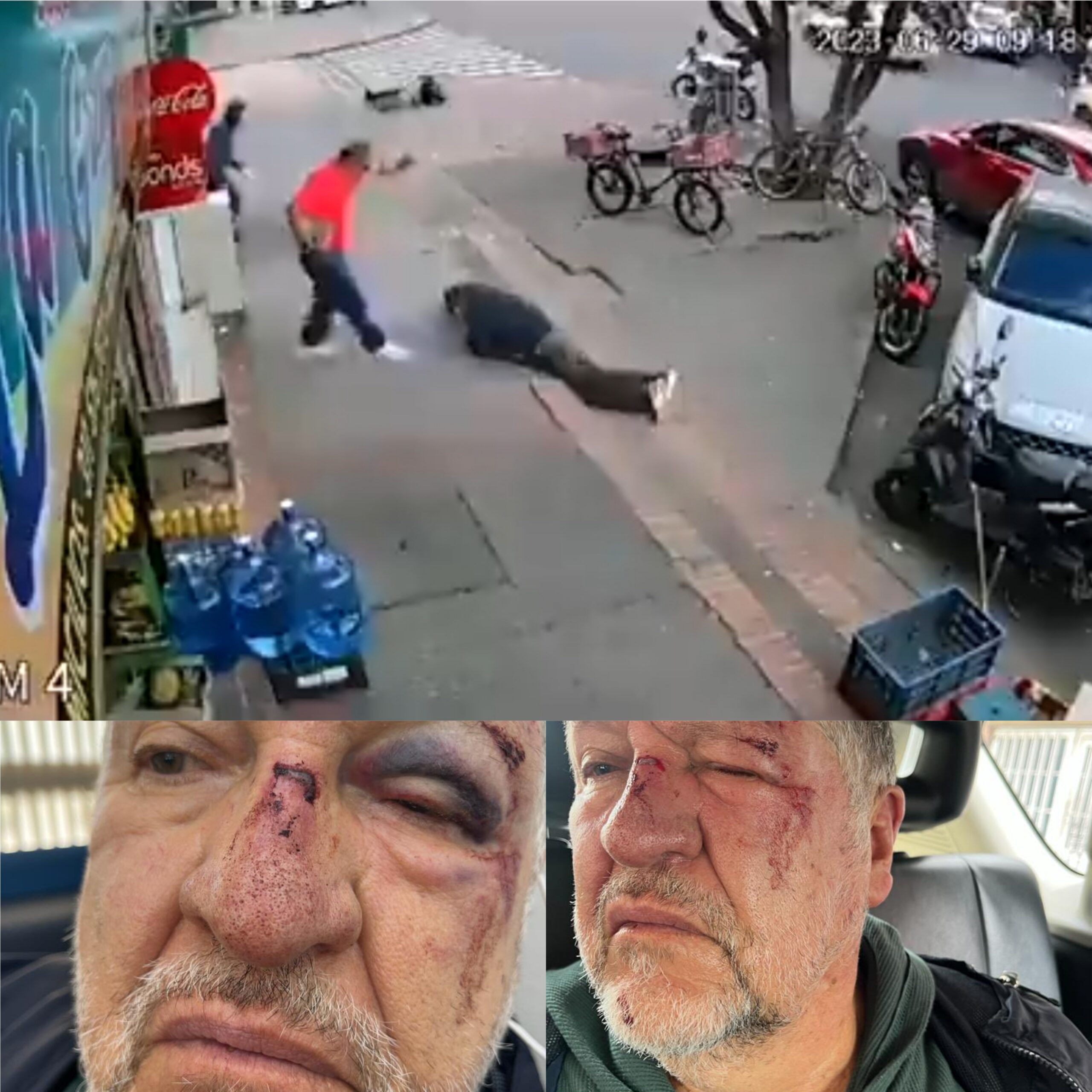 Adulto mayor que intentó sostenerse de otro al tropezar fue brutalmente golpeado