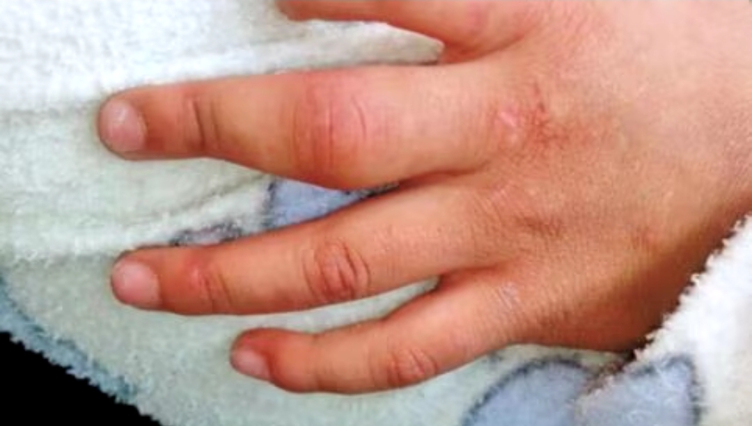 Cae encargado de centro de rehabilitación en Tonalá que quemó y dio descargas eléctricas a niña internada