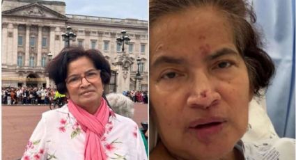 Quería conocer a la Virgen de Fátima, viajó y terminó amputada de manos y piernas por una terrible bacteria