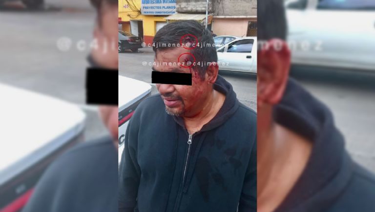 Increíble: le disparan dos veces en la cabeza, pero le rebotan las balas