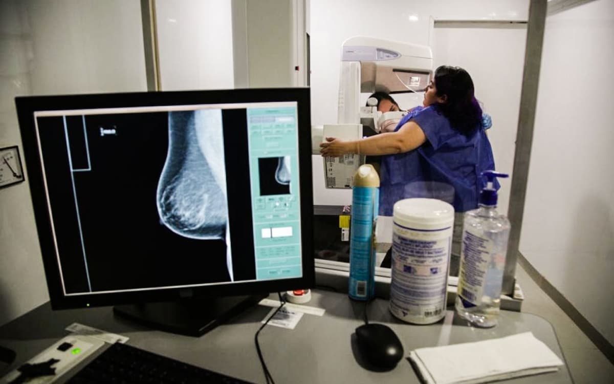Inteligencia Artificial aumenta un 20% detección de cáncer de mama: estudio