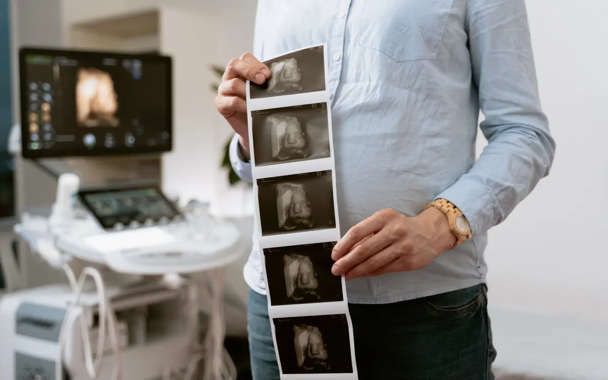 Mujer con dos úteros se embaraza en los dos al mismo tiempo