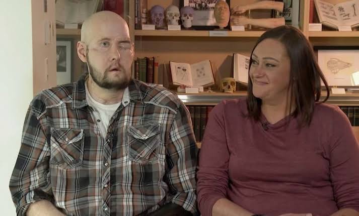 Por primera vez, transplantan un ojo entero a paciente