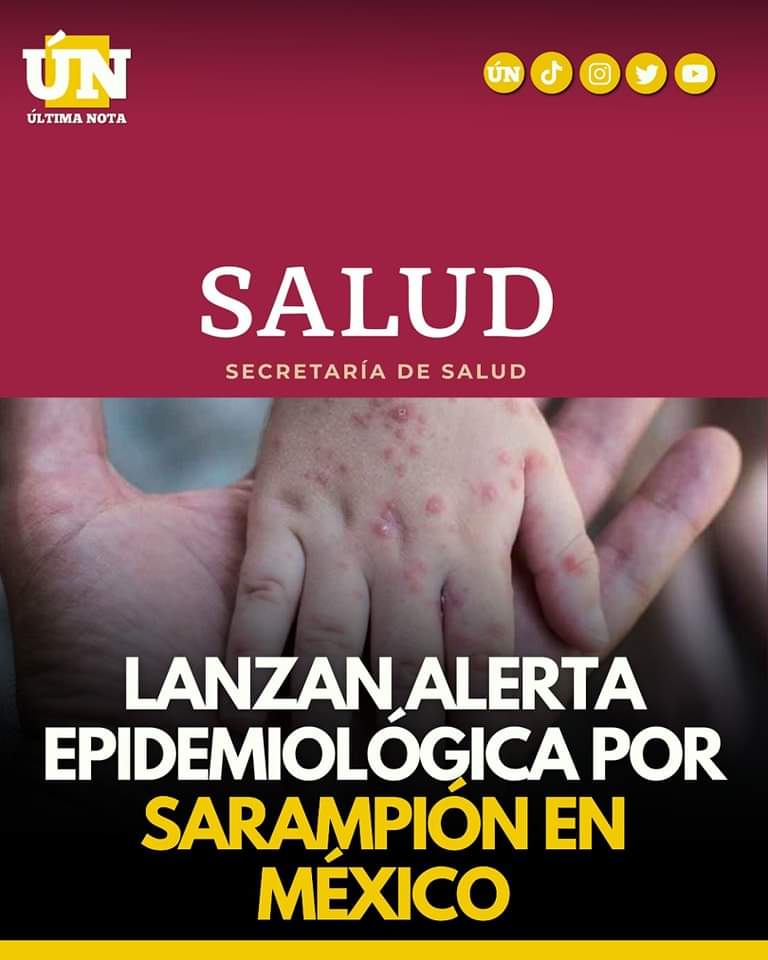 Nuevo aviso epidemiológico por sarampión: Padres, ¡vacunen a sus hijos!