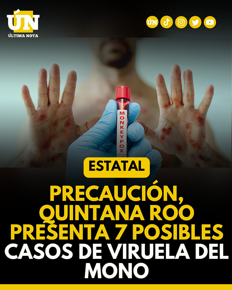 Quintana Roo en Alerta: Posibles Casos de Viruela Símica