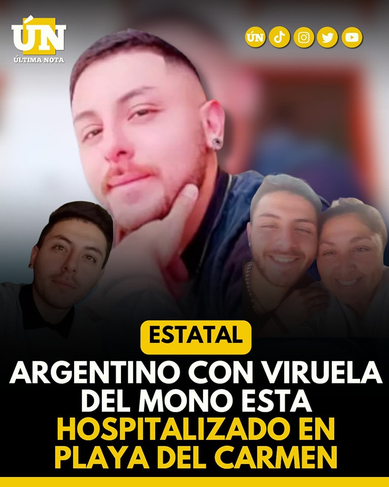 Joven argentino lucha por su vida en Playa del Carmen tras contraer viruela del mono