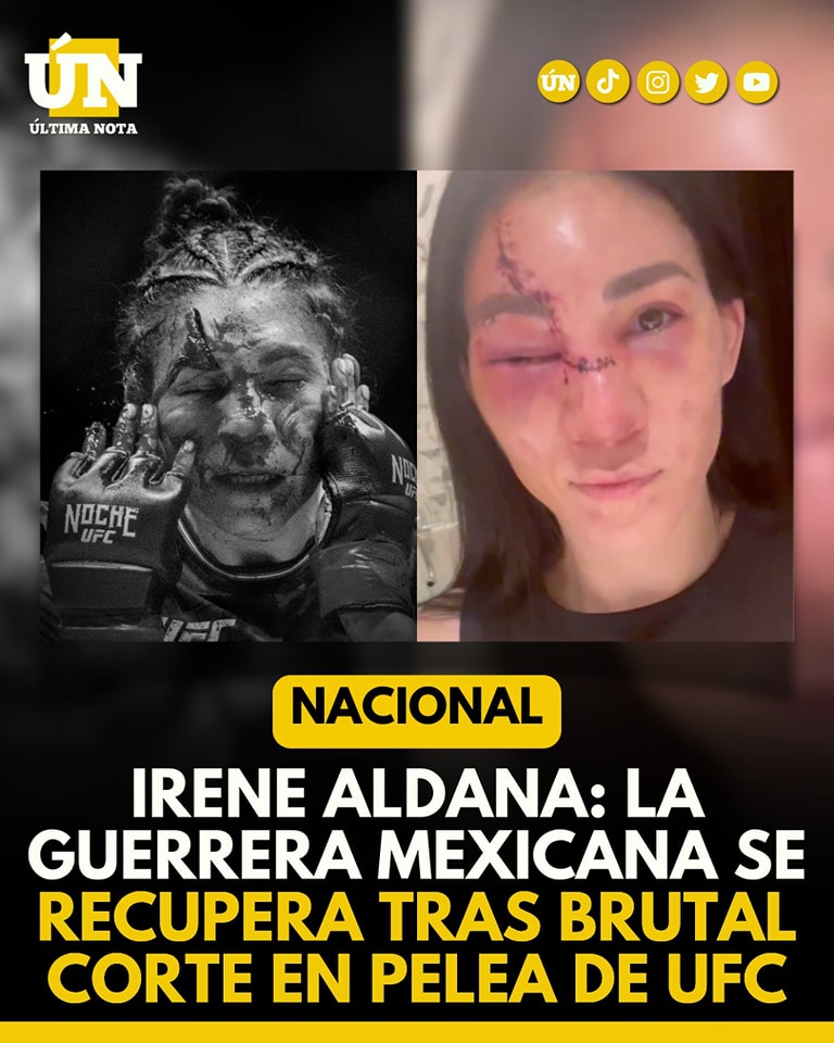 Irene Aldana: La guerrera mexicana se recupera tras brutal corte en pelea de UFC