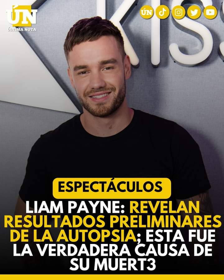 Revelan Resultados Preliminares de la Autopsia y la Causa de Su Muert3 Liam Payne