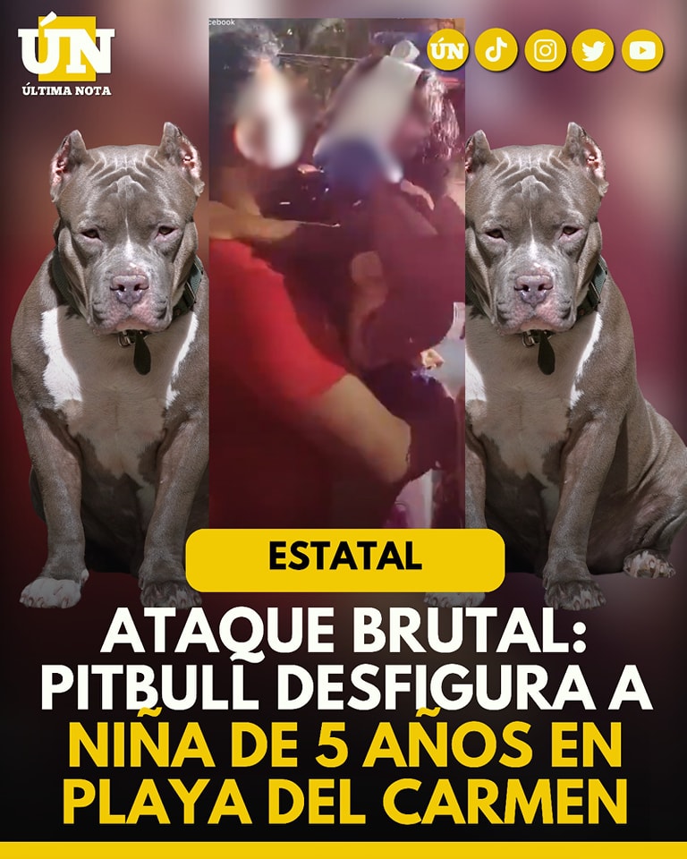 Ataque brutal: pitbull desfigura a niña de 5 Años en Playa del Carmen