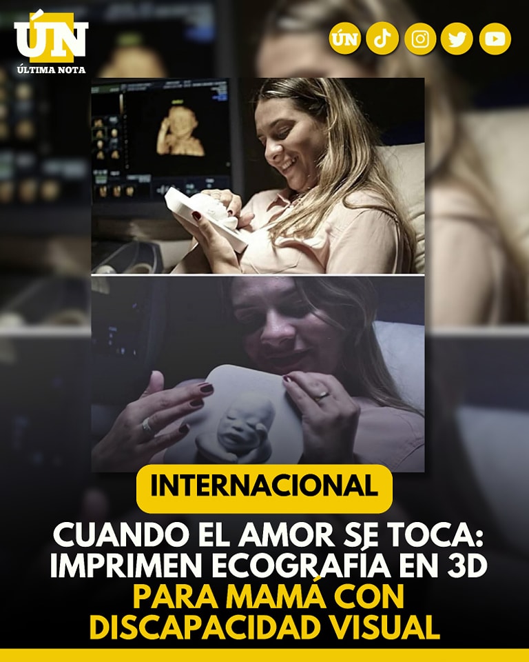 Cuando el amor se toca: imprimen ecografía en 3D para mamá con discapacidad visual