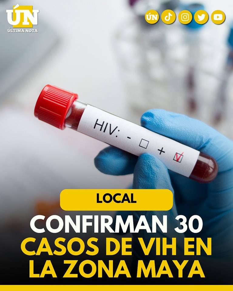 Confirman 30 casos de VIH en la Zona Maya