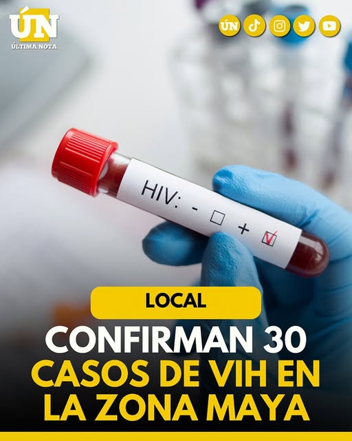 Confirman 30 casos de VIH en la Zona Maya