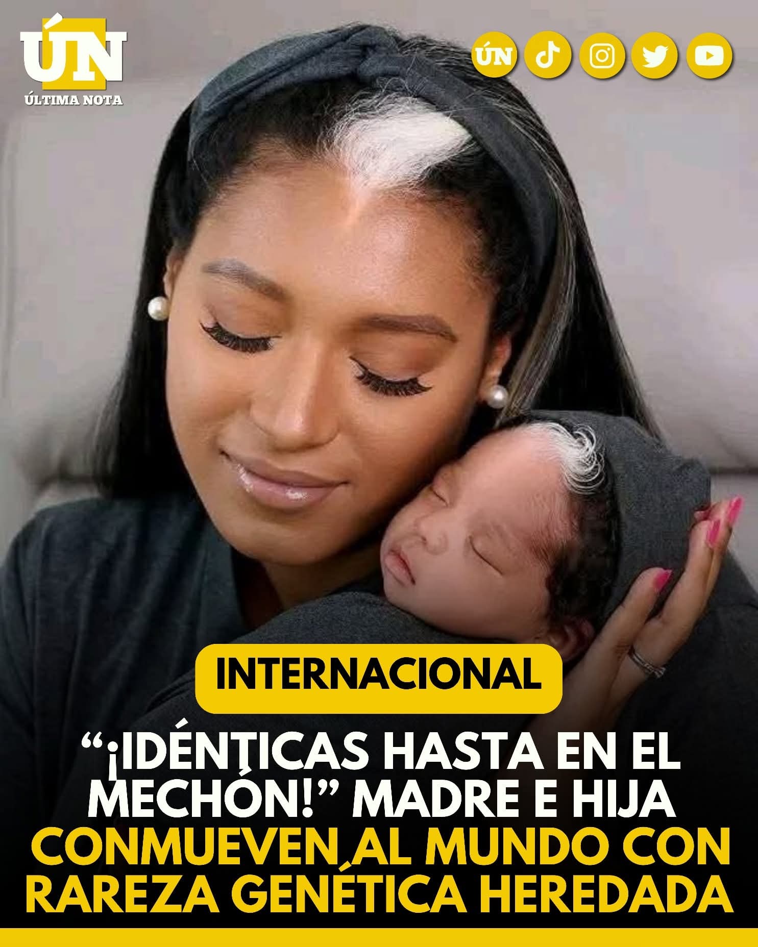 “¡Idénticas hasta en el mechón!” Madre e hija conmueven al mundo con rareza genética heredada.