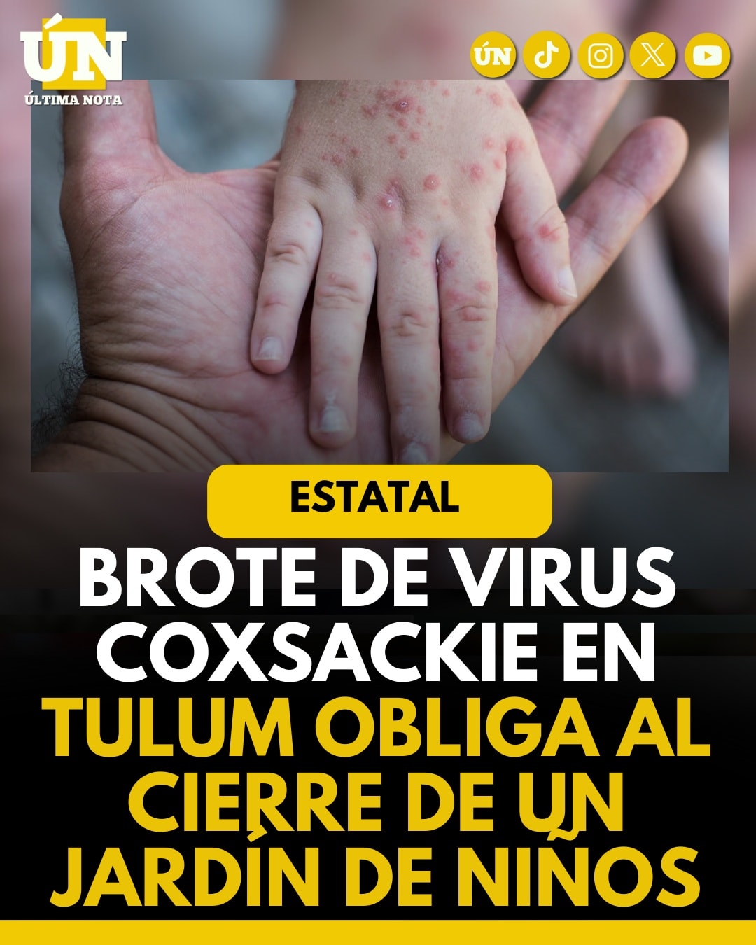 Brote de virus Coxsackie en Tulum obliga al cierre de un jardín de niños